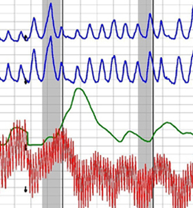 Fresno polygraph test